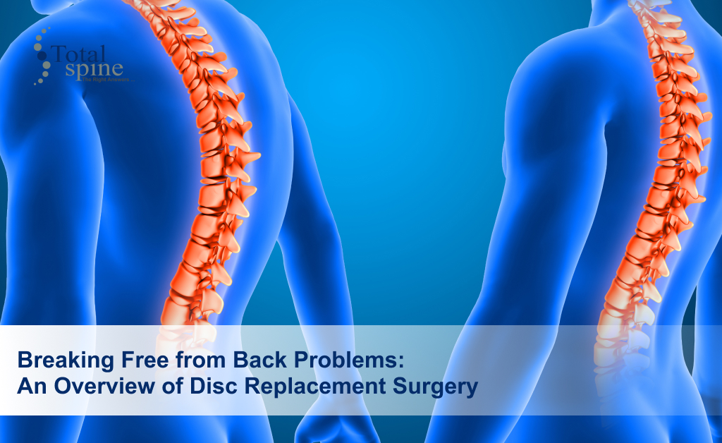 Disc Replacement Surgery in Chennai