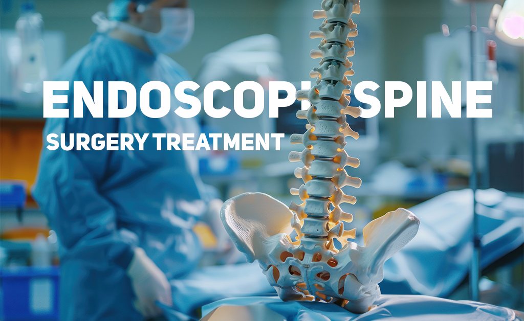 Endoscopic Spine Surgery Treatment in Chennai