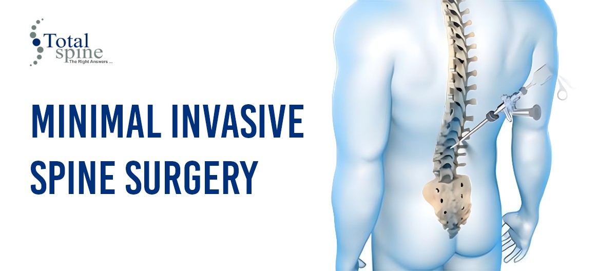 Minimally Invasive Spine Surgeon in Chennai