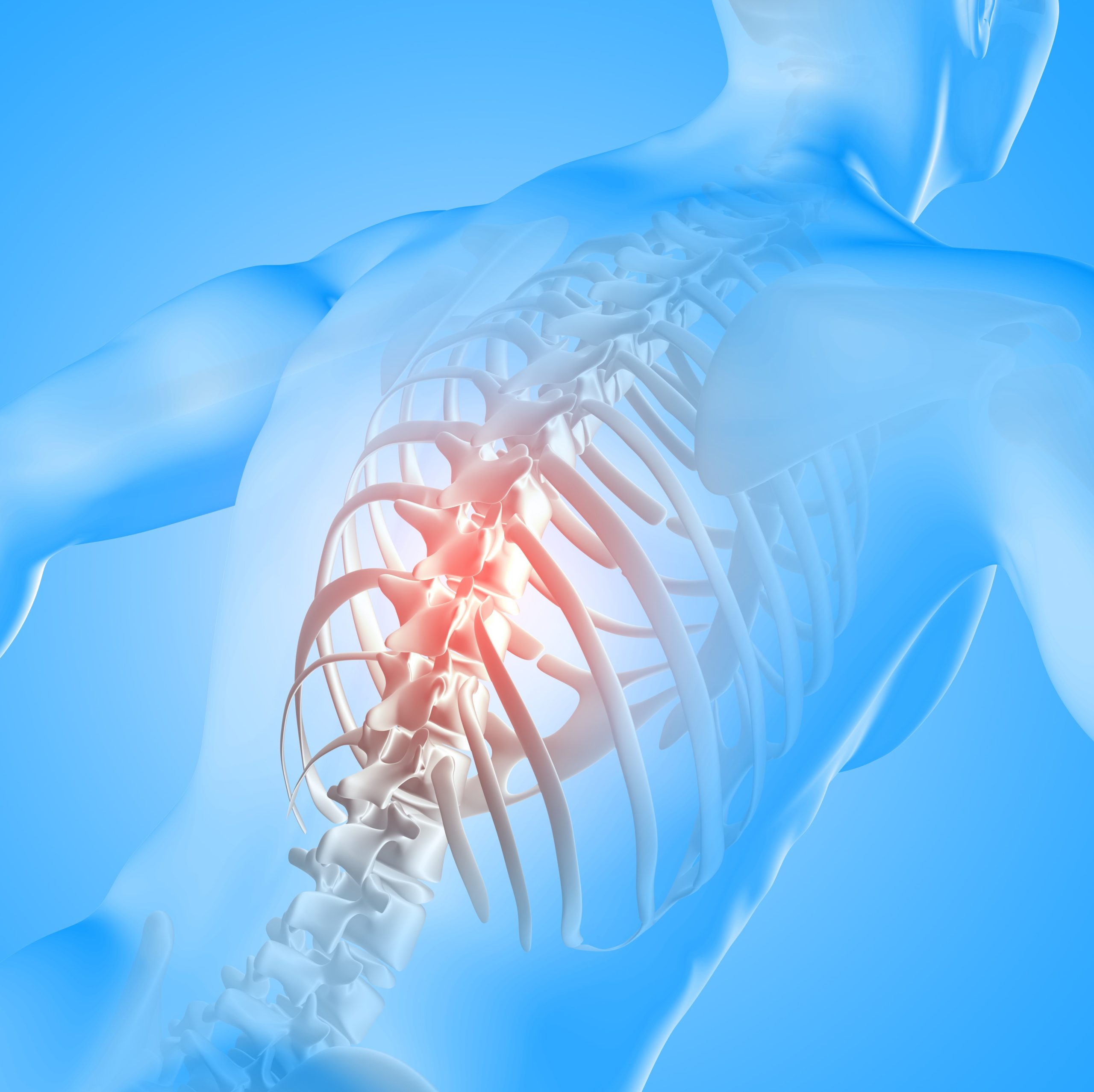 Spine Fracture Treatment in Chennai