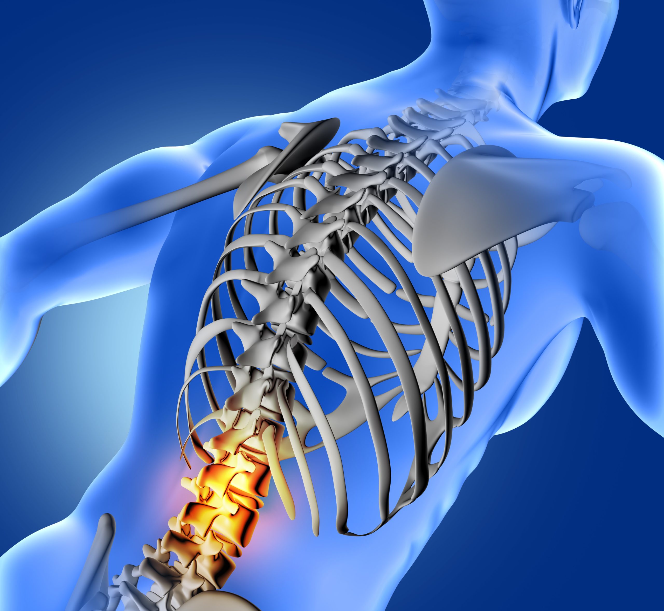 Spine Diagnostic Centre in Chennai